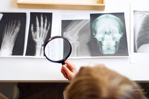 x-rays. Radiografias para tem preescolar sobre el esqueleto